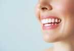 Refaire ses dents quand passer par l'orthodontie adulte