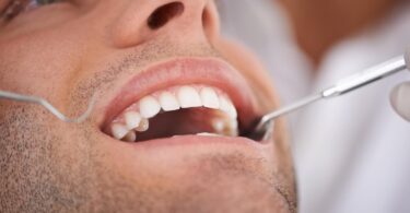 Gencives enflammées après rendez-vous chez le dentiste