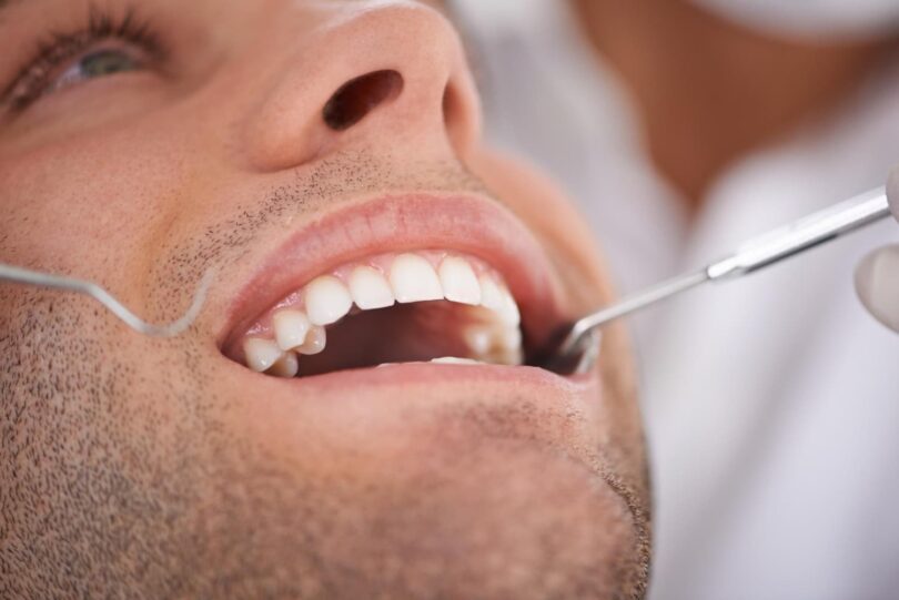 Gencives enflammées après rendez-vous chez le dentiste